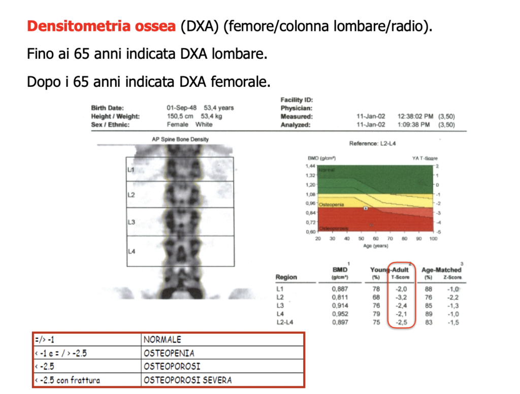 densitometria ossea