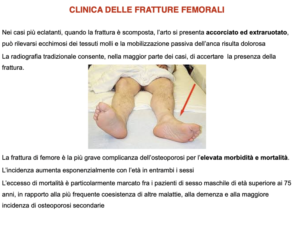 clinica delle fratture femorali